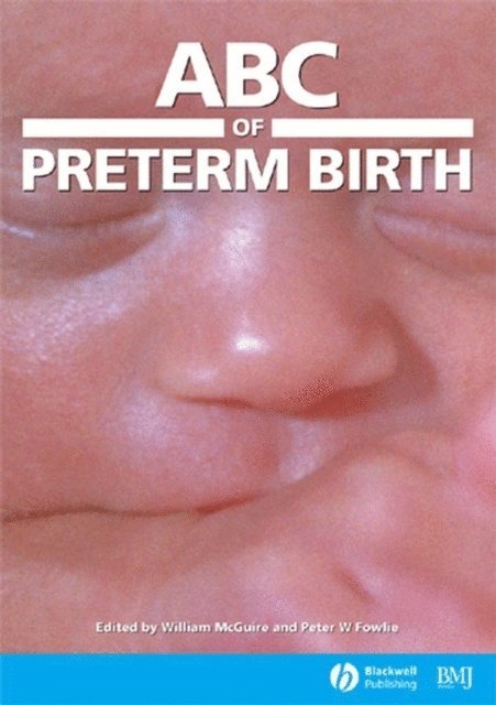 Peter W. Fowlie, William McGuire - ABC of Preterm Birth, E-bok