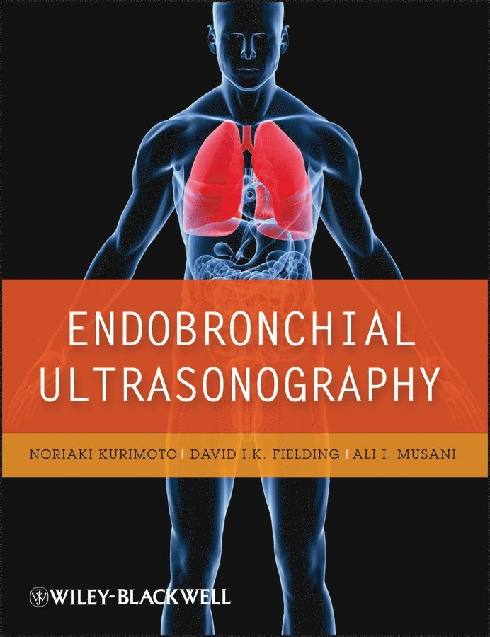 N Kurimoto, Noriaki Kurimoto, David I. K. Fielding, Ali I. Musani - Endobronchial Ultrasonography, E-bok. Tillgänglighet: Tillfälligt slut