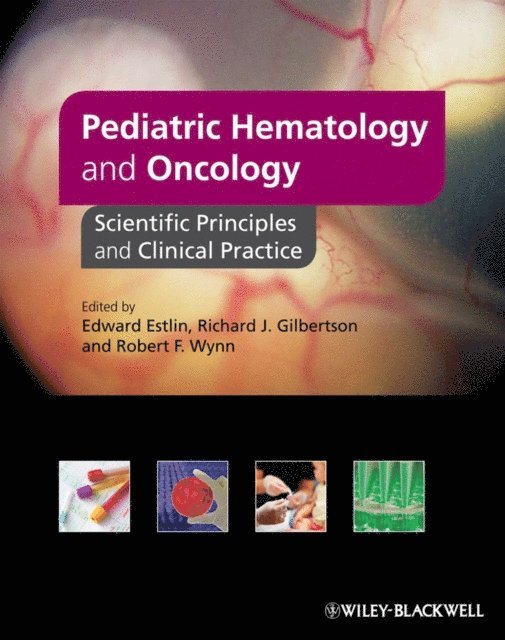Rob Wynn, Richard Gilbertson, Edward Estlin - Pediatric Hematology and Oncology, E-bok
