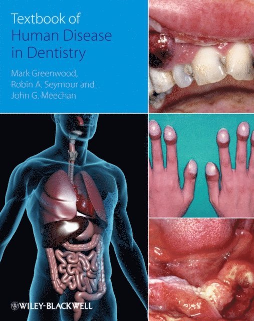 John Meechan, Robin Seymour, Mark Greenwood - Textbook of Human Disease in Dentistry, E-bok