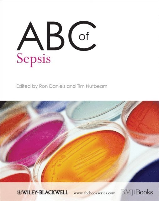 Tim Nutbeam, Ron Daniels - ABC of Sepsis, E-bok