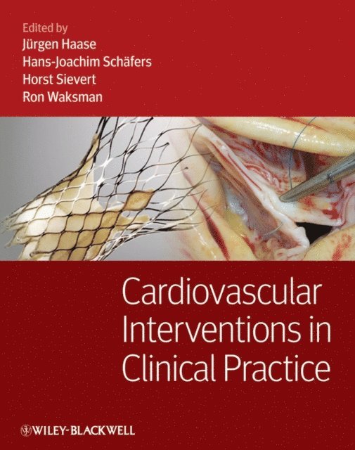 Ron Waksman, Horst Sievert, Hans-Joachim Sch fers, J rgen Haase - Cardiovascular Interventions in Clinical Practice, E-bok