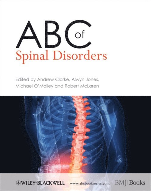 Robert McLaren, Michael O'Malley, Alwyn Jones, Andrew Clarke - ABC of Spinal Disorders, E-bok