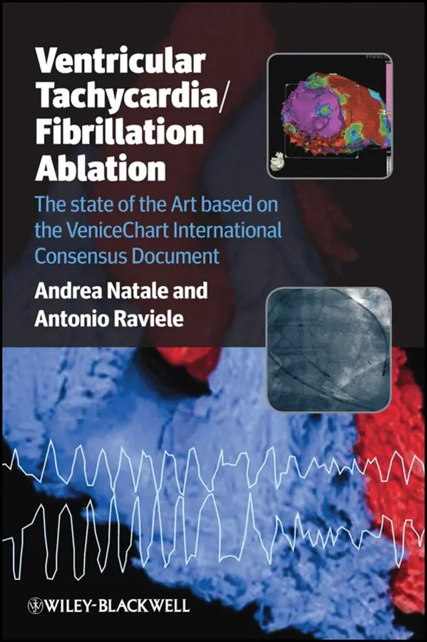 Andrea Natale, Antonio Raviele - Ventricular Tachycardia / Fibrillation Ablation – The State of the Art based on the Venicechart International Consensus Document 2e. Tillgänglighet: Tillfälligt slut