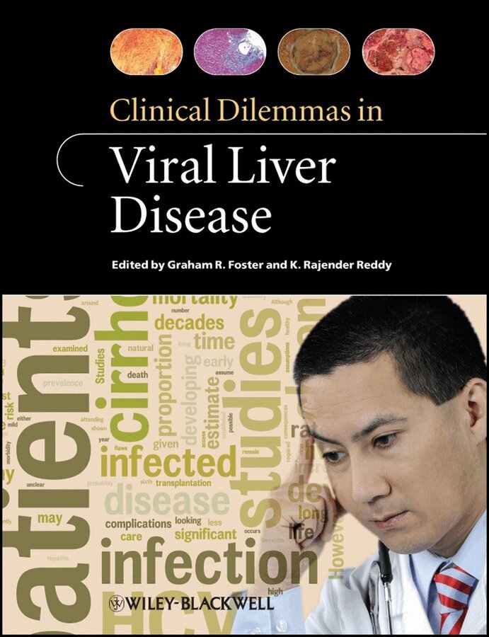 Graham R. Foster, K Rajender Reddy - Clinical Dilemmas in Viral Liver Disease. Tillgänglighet: Tillfälligt slut
