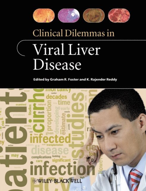 K Rajender Reddy, Graham R. Foster - Clinical Dilemmas in Viral Liver Disease, E-bok