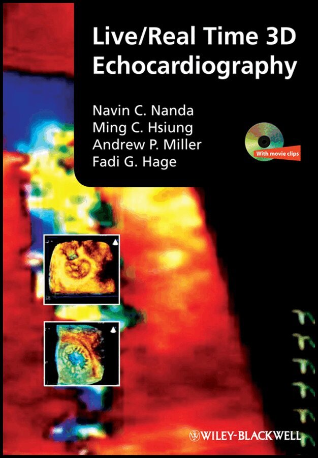 Navin Nanda, Ming Chon Hsiung, Andrew P. Miller, Fadi G. Hage - Real Time 3D Transthoracic Echocardiography. Tillgänglighet: Tillfälligt slut