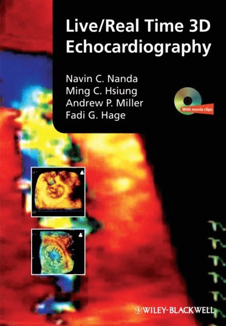 Fadi G. Hage, Andrew P. Miller, Ming Chon Hsiung, Navin Nanda - Live/Real Time 3D Echocardiography, E-bok