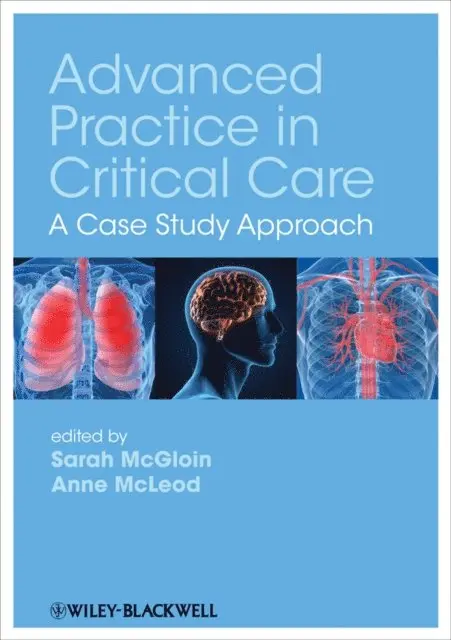 Anne McLeod, Sarah McGloin - Advanced Practice in Critical Care, E-bok. Tillgänglighet: Lägg i varukorg