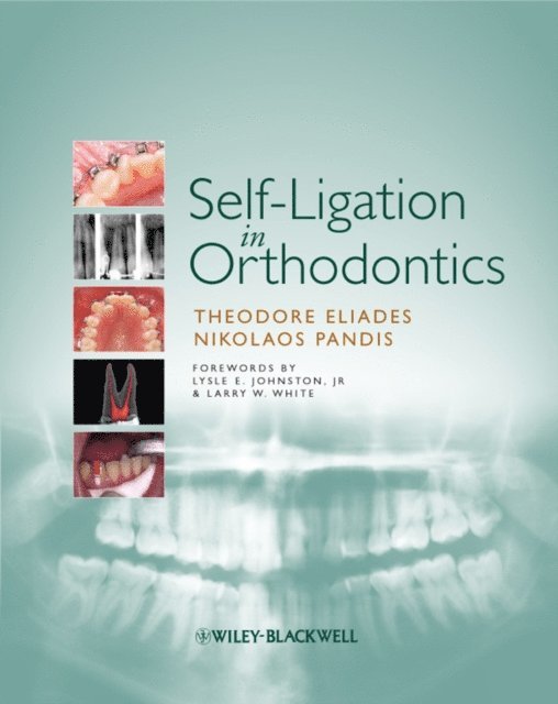 Nikolaos Pandis, Theodore Eliades - Self-Ligation in Orthodontics, E-bok
