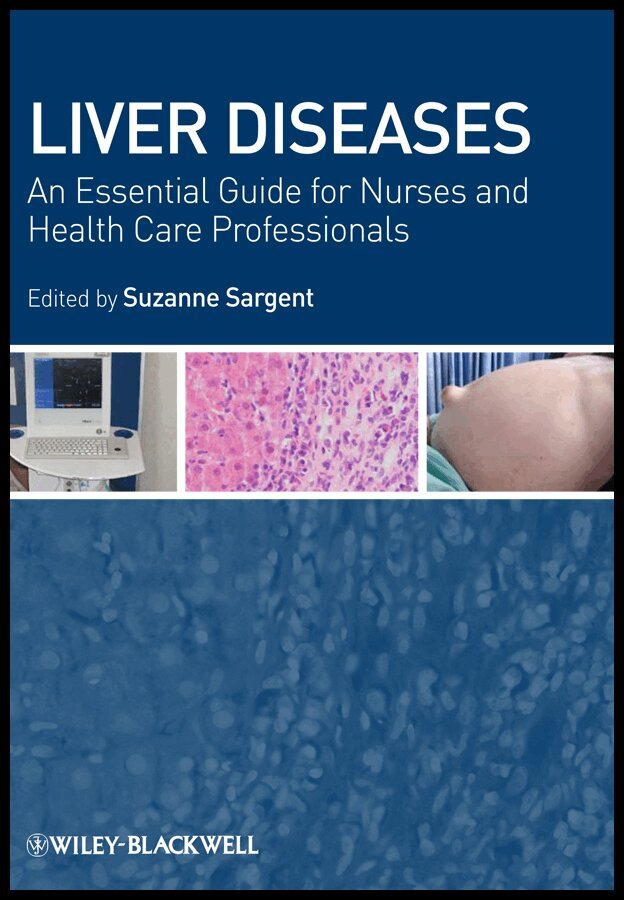 Suzanne Sargent - Liver Diseases – An Essential Guide for Nurses and Health Care Professionals. Tillgänglighet: Tillfälligt slut