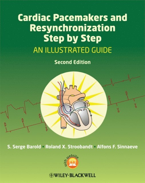 Alfons F. Sinnaeve, Roland X. Stroobandt, S. Serge Barold - Cardiac Pacemakers and Resynchronization Step by Step, E-bok