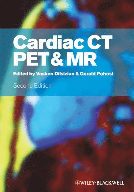Gerald M. Pohost, Vasken Dilsizian - Cardiac CT, PET and MR, E-bok