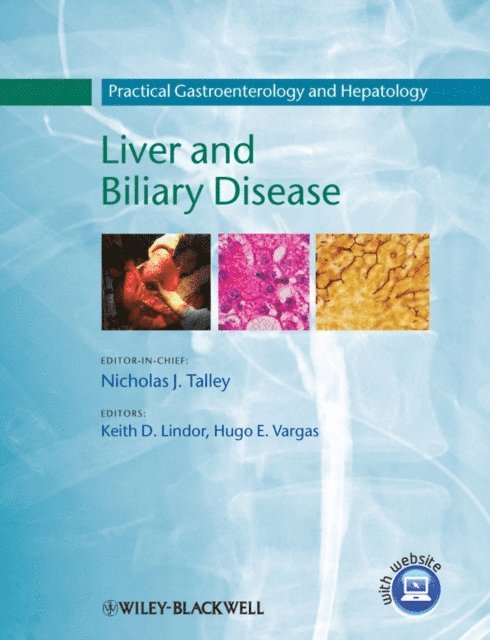 Hugo E. Vargas, Keith D. Lindor - Practical Gastroenterology and Hepatology, E-bok