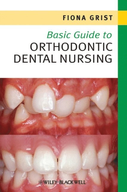 Fiona Grist - Basic Guide to Orthodontic Dental Nursing, E-bok