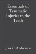 Essentials of Traumatic Injuries to the Teeth