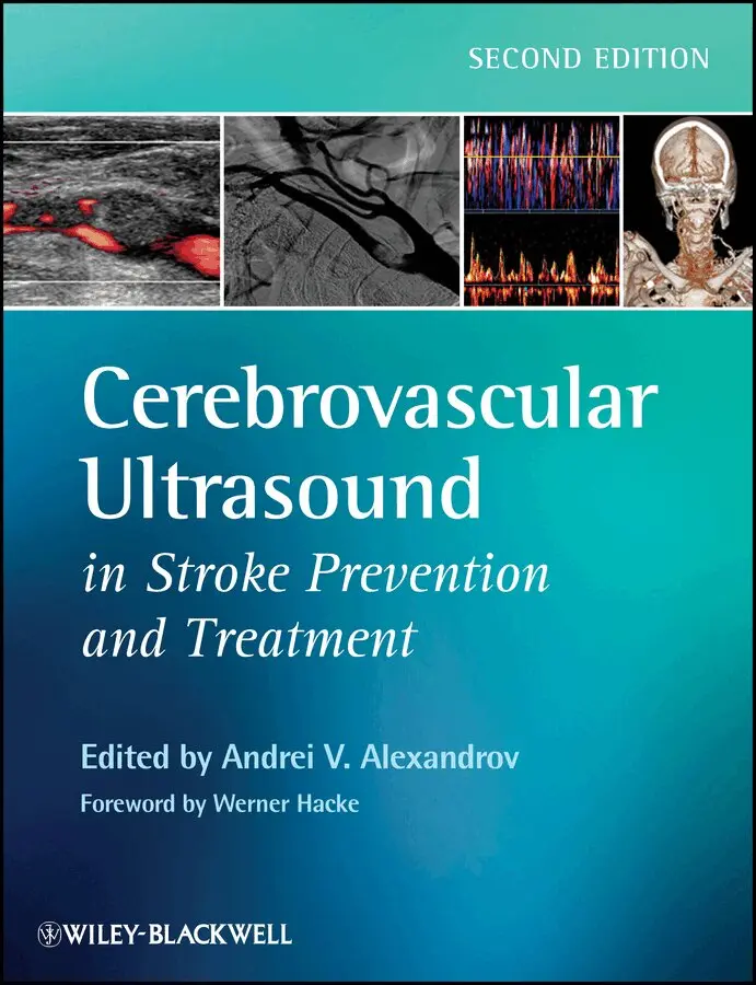 Andrei V. Alexandrov - Cerebrovascular Ultrasound in Stroke Prevention and Treatment. Tillgänglighet: Tillfälligt slut
