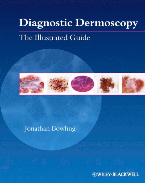 Jonathan Bowling - Diagnostic Dermoscopy, E-bok