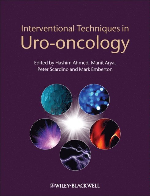 Mark Emberton, Peter Scardino, Hashim Uddin Ahmed, Manit Arya - Interventional Techniques in Uro-oncology, E-bok