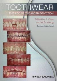 Orthodontic Management Of The Dentition With The Pre - 