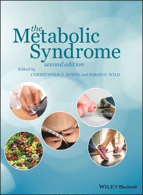 Christopher D. Byrne, Christopher D. Byrne, Sarah H. Wild - Metabolic Syndrome, Inbunden