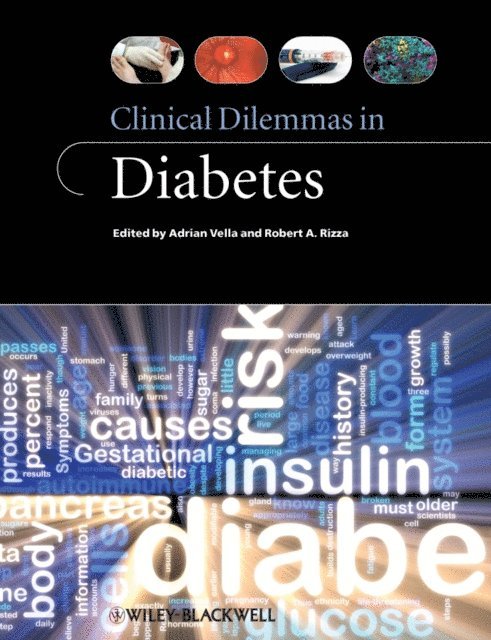 Robert A. Rizza, Adrian Vella - Clinical Dilemmas in Diabetes, E-bok