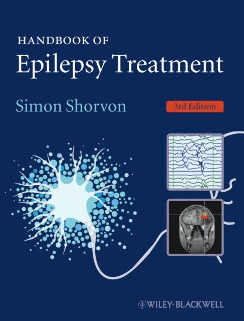 Simon Shorvon - Handbook of Epilepsy Treatment, E-bok