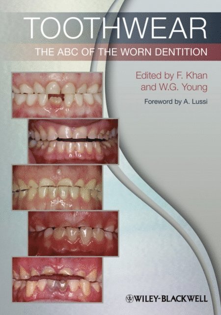 William G. Young, Farid Khan - Toothwear, E-bok