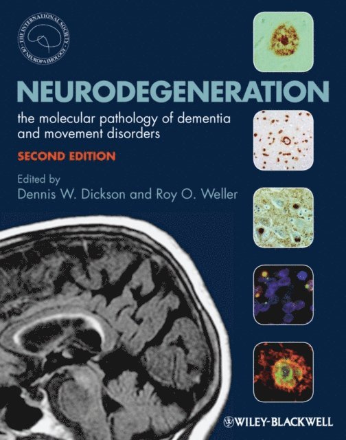 Roy O. Weller, Dennis Dickson - Neurodegeneration, E-bok