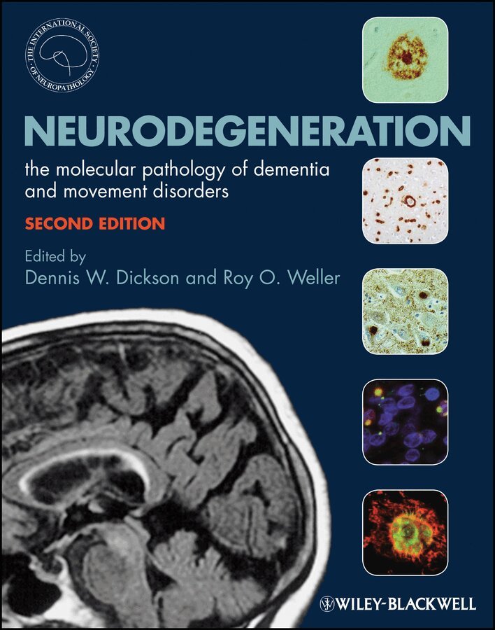 Dennis Dickson, Roy O. Weller - Neurodegeneration – The Molecular Pathology of Dementia and Movement Disorders. Tillgänglighet: Tillfälligt slut