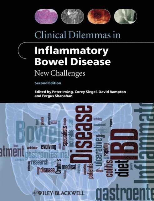 Fergus Shanahan, David Rampton, Corey A. Siegel, MRCP Peter Irving, MD - Clinical Dilemmas in Inflammatory Bowel Disease, E-bok