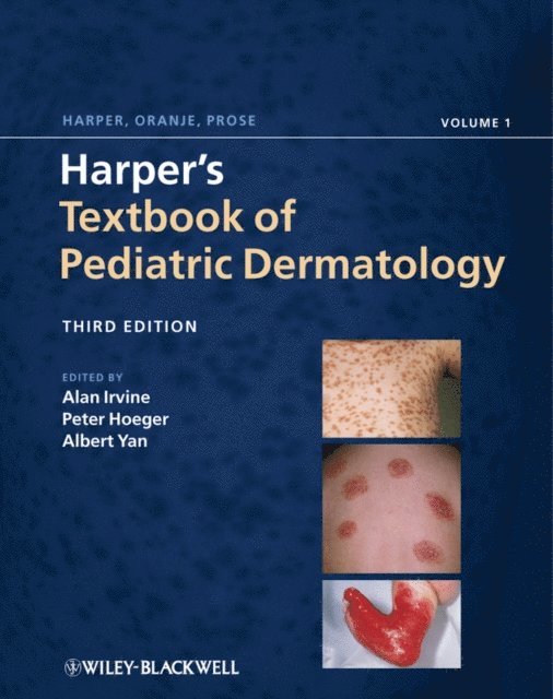 Albert C. Yan, Peter H. Hoeger, Alan D. Irvine - Harper's Textbook of Pediatric Dermatology, E-bok