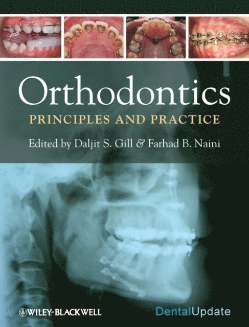 Farhad B. Naini, Daljit S. Gill - Orthodontics, E-bok