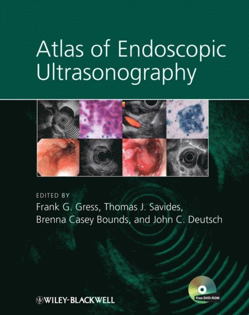 John C. Deutsch, Brenna C. Bounds, Thomas J. Savides, Frank G. Gress - Atlas of Endoscopic Ultrasonography, E-bok. Tillgänglighet: Lägg i varukorg
