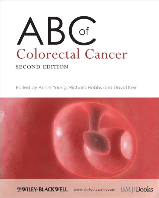 David J. Kerr, Richard Hobbs, Annie M. Young - ABC of Colorectal Cancer, E-bok