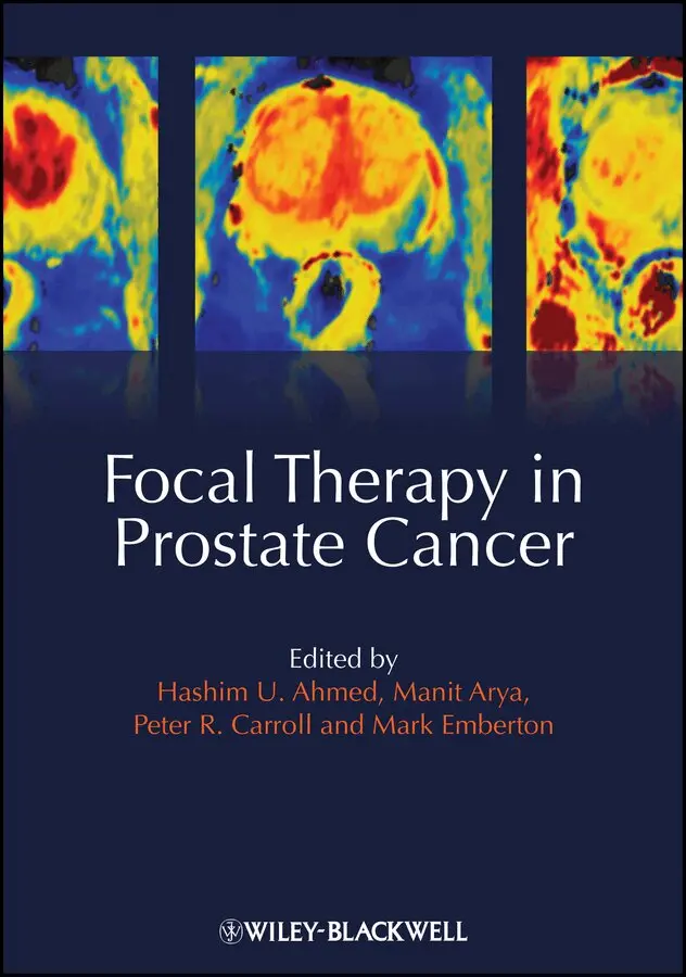 Hashim Uddin Ahmed, Manit Arya, Peter R. Carroll, Mark Emberton - Focal Therapy in Prostate Cancer. Tillgänglighet: Tillfälligt slut