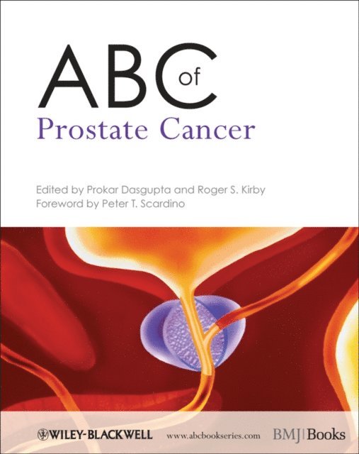 Roger S. Kirby, Prokar Dasgupta - ABC of Prostate Cancer, E-bok