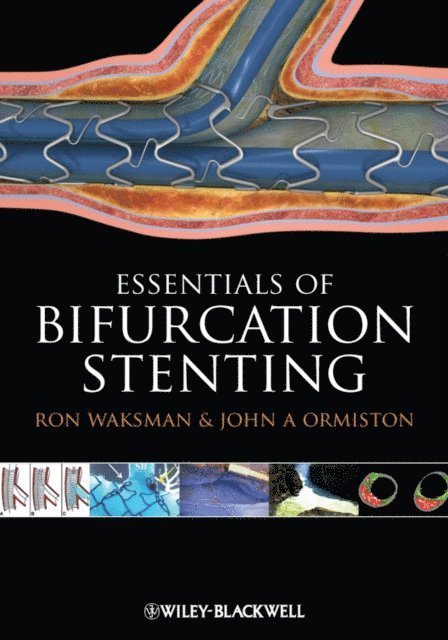 John A. Ormiston, Ron Waksman - Bifurcation Stenting, E-bok
