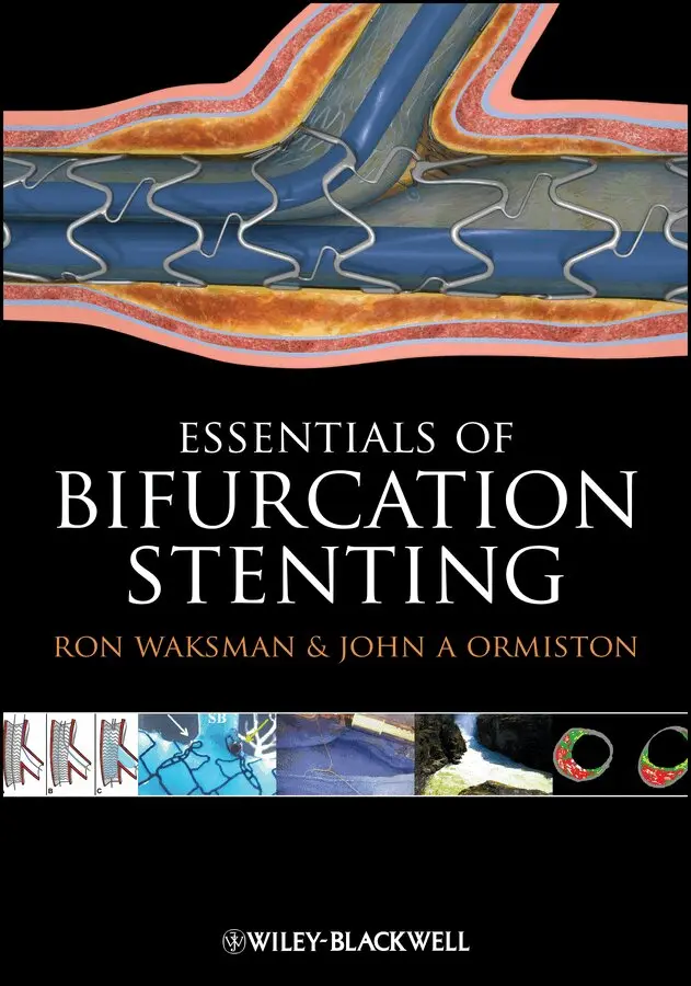 Ron Waksman, John A. Ormiston - Bifurcation Stenting. Tillgänglighet: Tillfälligt slut