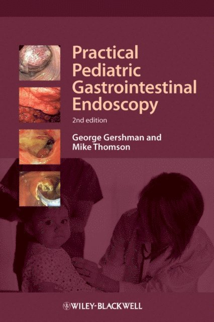 Mike Thomson, George Gershman - Practical Pediatric Gastrointestinal Endoscopy, E-bok