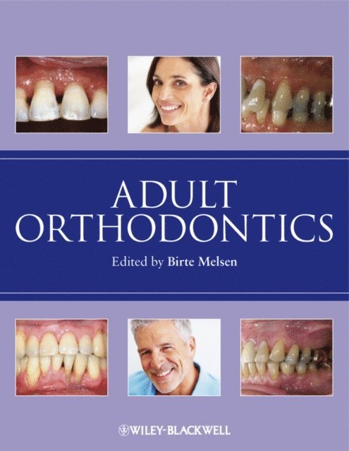 Birte Melsen - Adult Orthodontics, E-bok