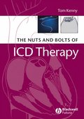 Nuts and Bolts of ICD Therapy