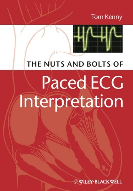 Tom Kenny - Nuts and bolts of Paced ECG Interpretation, E-bok
