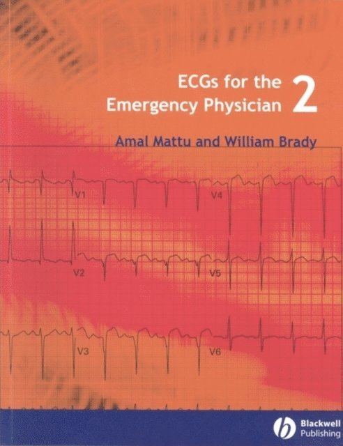 William J. Brady, Amal Mattu - ECGs for the Emergency Physician 2, E-bok