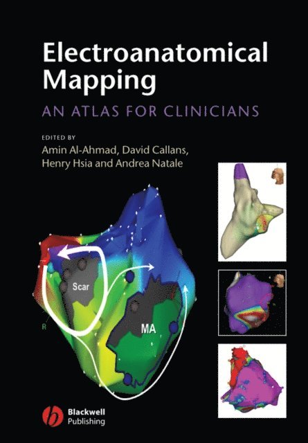 Andrea Natale, Henry H. Hsia, David J. Callans, Amin Al-Ahmad - Electroanatomical Mapping, E-bok