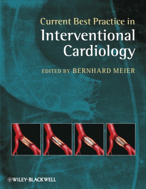 Bernhard Meier - Current Best Practice in Interventional Cardiology, E-bok