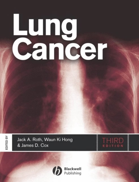 Waun Ki Hong, James D. Cox, Jack A. Roth - Lung Cancer, E-bok