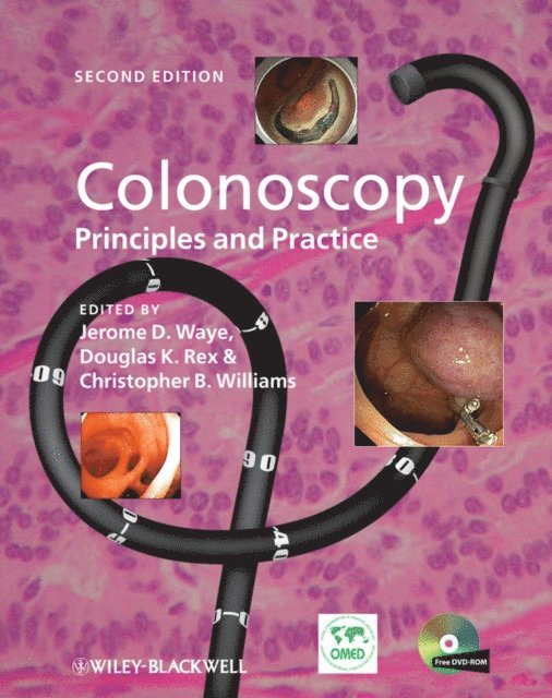 Christopher B. Williams, Douglas K. Rex, Jerome D. Waye - Colonoscopy, E-bok