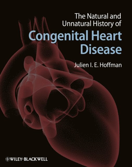Julien I. E. Hoffman - Natural and Unnatural History of Congenital Heart Disease, E-bok