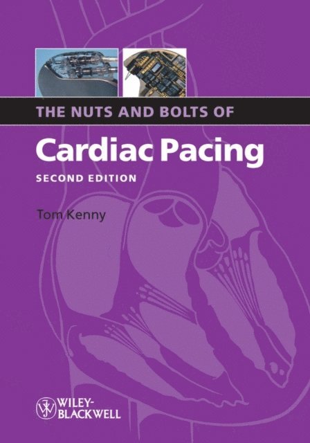 Tom Kenny - Nuts and Bolts of Cardiac Pacing, E-bok